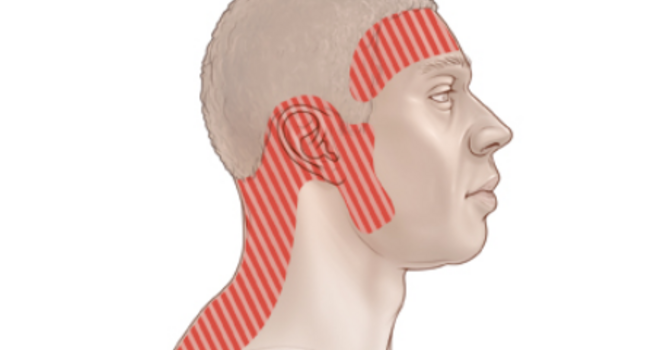 6 TIPS TO EASE TENSION HEADACHES